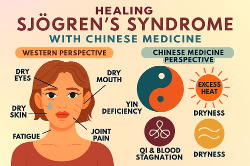 Healing Sjögren’s disease disease with Chinese medicine